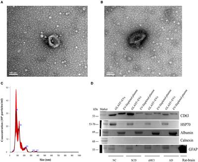 MCP-1 levels in astrocyte-derived exosomes are changed in preclinical stage of Alzheimer's disease